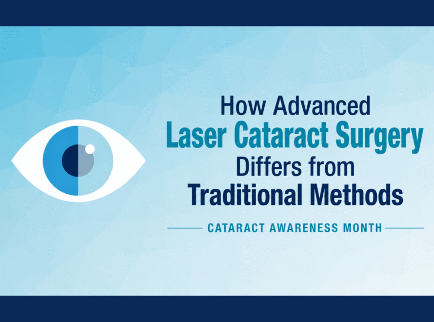 Laser Cataract Surgery