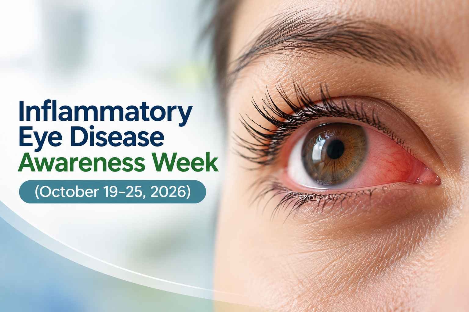 Close-up of a red, irritated eye highlighting inflammatory eye disease awareness, October 19–25, 2026.